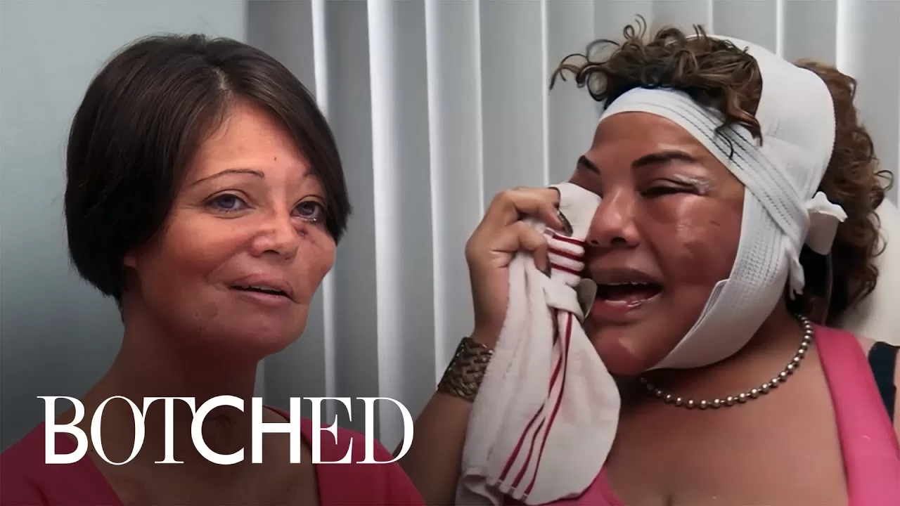 5 Touching & Emotional Patient Stories on “Botched” Botched E