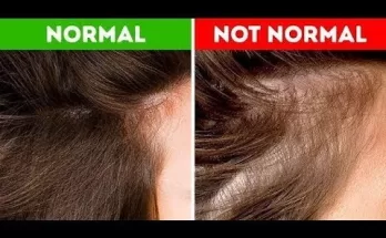 Hair Health - What Your Hair Can Tell You